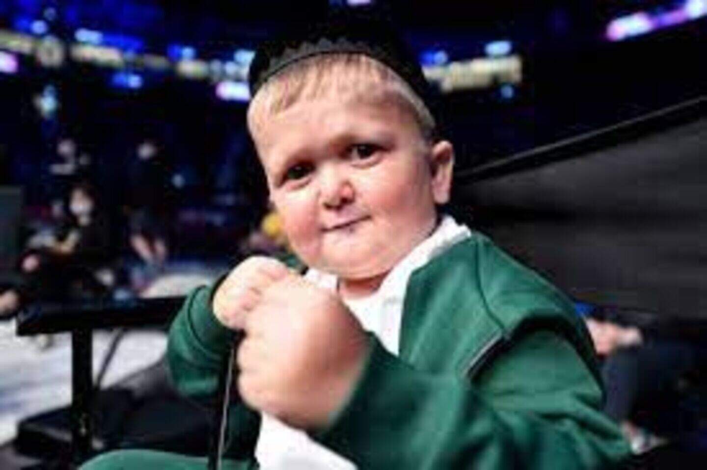 UFC star Conor McGregor calls internet sensation Hasbulla a ‘gimp’ who ...